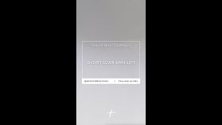 Patient Journey: Short Scar Arm Lift