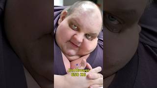 Top 5 Fattest Persons in the World  🌎 #viralshorts #shorts #viral #youtubeshorts