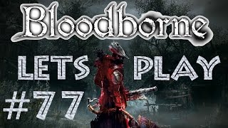 Let´s Play | Bloodborne & The Old Hunters | Folge #77 | Da wart ihr zu langsam, Viecher.