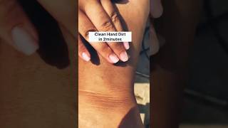 😱Clean Hand n Feet Dirt in 2minutes#viralshorts2024 #RiseBeauty