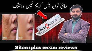 siton plus cream uses | how to uses siton plus cream | hyperpigmentation| malasma | chaiyon ka cream