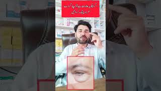 aghir apko ye alamat zaheer hu tu zaror gordo ke chackup kare #shortviral #viral