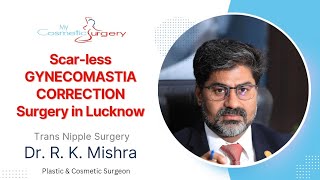 Scar-less Gynecomastia Surgery Lucknow | Male Breasts Correction by Dr. R. K. Mishra #gynecomastia