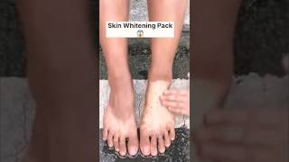 🔥Skin Tan Removal Challenge😱#shorts#tanremoving #Rise Beauty#ytshortsindia#you tube viral video