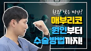 매부리코수술 후 다시 자랄수도 있나요?매부리코 원인부터 유형별 수술방법!  (hump nose, bump nose, hump reduction)