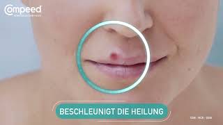 Compeed® Herpesbläschen Patch - Beschleunigt Heilung - non -comp