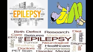 Epilepsy Seizures|warning signs of epilepsy|Does seizures happen at night #EpilepsySeizures#Epilepsy