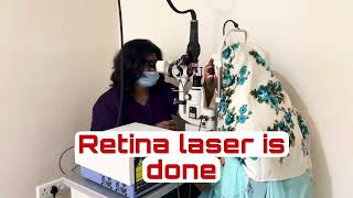 How is RETINA LASER done? #lasereyesurgery #retinalaser