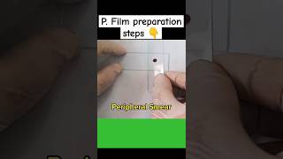 #medicallaboratory #laboratorymedicine #bloodfilm #pfilm #labtech #dmlt #microscope #mltclasses