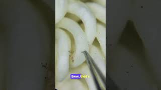 Ramen Under the Microscope: Hidden Bugs Exposed!