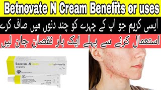 Betnovate Cream Review | Betnovate uses, Benefits and Side effects Hindi in Urdu / Betnovate N cream