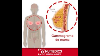 Gammagrama de mama