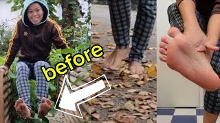 barefoot autumn in germany / cleaning the falling leaves in the yard and the street