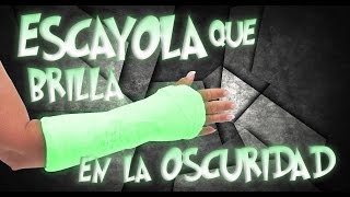 ¡La escayola que brilla en la oscuridad!