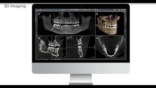 Dentsply Sirona Orthophos SL 3D Animation