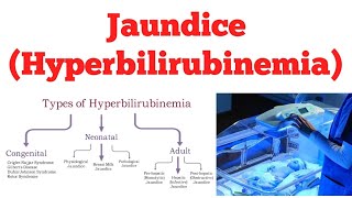 Hyperbilirubinemia || Jaundice || #Biochemistry