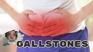 Decoding Gallstones: Causes, Symptoms, and Solutions