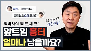 앞트임 흉터 어느 정도로 남나요?ㅣ앞트임 흉터 예방법과 흉터 치료법까지 총정리! - 의학박사 백승준