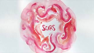 Bailey Bryan - Scars (Official Audio)