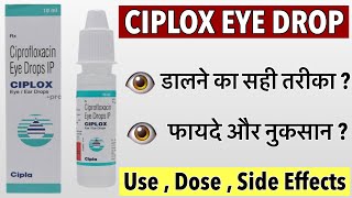 "Effective Relief for Eye Infections: Ciplox Eye Drops"