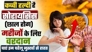 सोरायसिस का इलाज | Natural skin tag removal | कैसे कच्ची हल्दी से करे सोरायसिस (छाल रोग) को ठीक