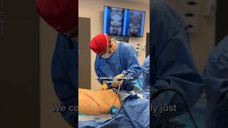 Doc performed liposuction 360 combined with a tummy tuck to tighten his figure post-weight loss!