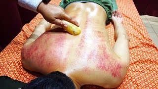 ASMR | Gua Sha "SKIN SCRAPING" Massage Therapy for Back Pain Relief