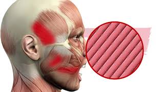 Articulación Temporomandibular