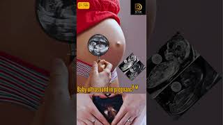 baby ultrasound in pregnancy week | pregnancy week by week scan #ultrasound #pregnancy #baby #yt