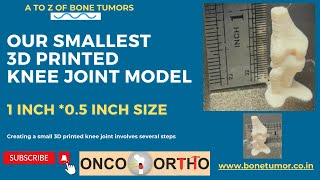 Smallest 3D Printed Knee Joint model