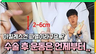 이게 아킬레스건 파열 증상? 아킬레스건 수술 후 운동은 언제쯤..