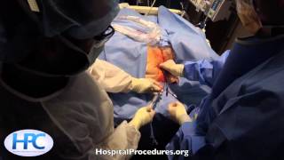 Ultrasound Guided Subclavian Vein Catheter Placement