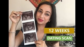 12 weeks pregnancy update - Dating scan