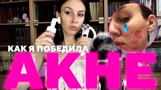 АСМР Как я победила АКНЕ