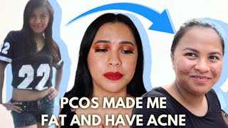 My PCOS Story / Weight Gain & Acne | Kim's Korner