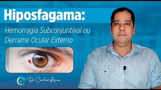 Hiposfagama: Hemorragia Subconjuntival ou Derrame Ocular Externo