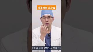 #비개방형 #비개방형코수술 #개방형 #코수술 #코성형