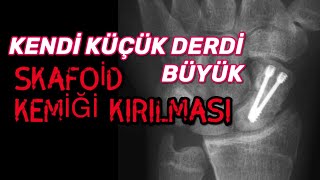 SKAFOİD KEMİĞİ KIRILMASI NEDİR VE TEDAVİSİ