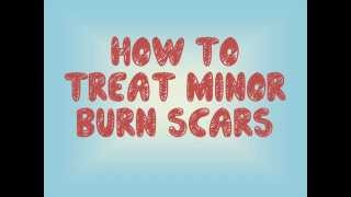 How To Treat Minor Burn Scars