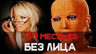 30 МЕСЯЦЕВ БЕЗ ЛИЦА [Шокирующая реальность #47]