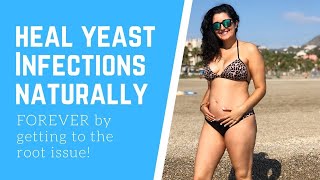 HOW TO HEAL/TREAT YEAST INFECTIONS NATURALLY FOR GOOD!