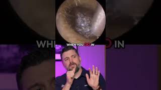 Watching HUGE chunks of EARWAX removed from patient’s ear!