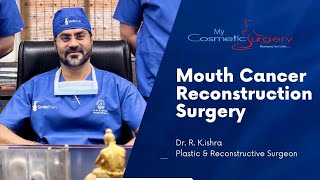 Cancer Reconstruction Surgery - Micro-vascular Osteo-cutaneous Fibula flap | Dr. R. K. Mishra