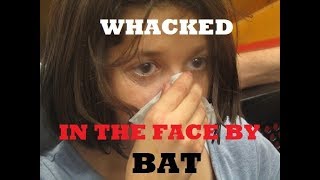 WHACKED IN THE FACE WITH A BAT *Blood Warning* - September 10, 2017