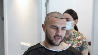 Paul's Hair Transplant Journey in Turkey I Clinic International