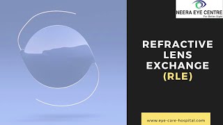 Refractive Lens Exchange Surgery (RLE) | Eye Surgeon | Eye Specialist In Delhi, India