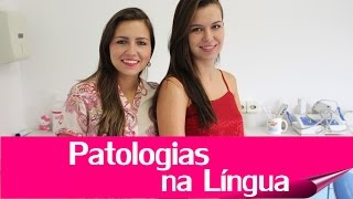 Patologias na Língua - Língua Geográfica