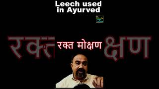 Use of Leech in Ayurveda