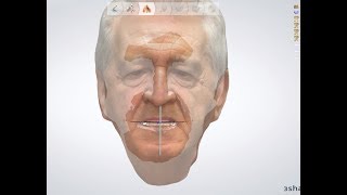 Full face scan, middle and lower face scan: the "digital patient"