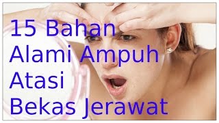 Wajib Nonton: 15 Bahan Alami Ampuh Atasi Bekas Jerawat | Harus Dicoba Ya!!!